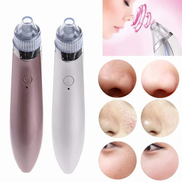 Blackhead Remover Pore Vacuum | Facial Acne Cleaner